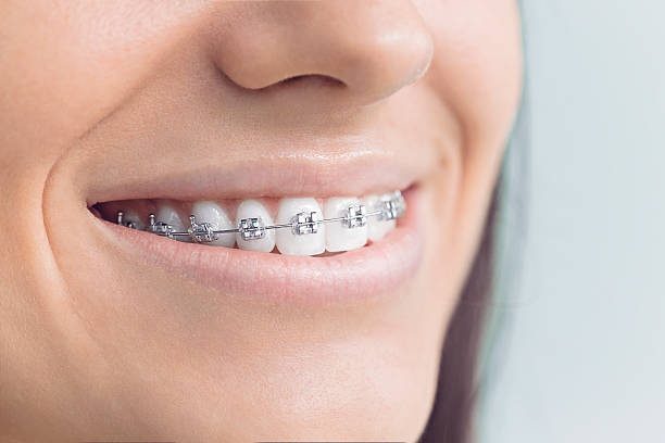 Best Invisalign and Clear Aligners  in Oquawka, IL